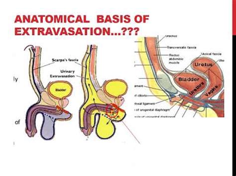 what is the gooch on the human body|Perineum